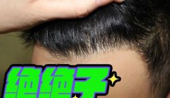 -大麦微针植发丨全国连锁