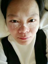 敷麻中……-美丽人生祛斑扁平疣汗管瘤中心
