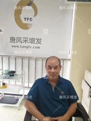 -唐风采假发补发定制