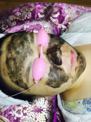 -美肤盾祛痘·问题肌头疗管理中心