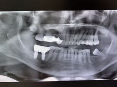 -土豆口腔(凤凰北总店)