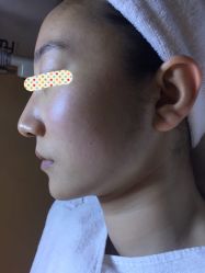 -皇族养心堂·净痘·修敏·御颜