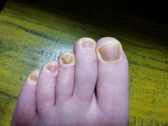 -新甲连锁灰指甲·甲沟炎·鸡眼(黑龙江路店)