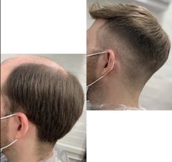 -发饰美男士增发补发假发定制店