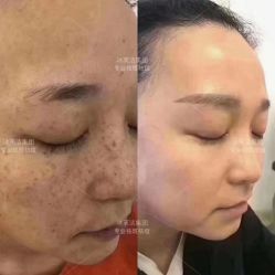 -冰芙洁问题性皮肤美甲美睫