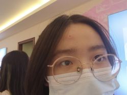 点击看大图 体验后-长沙雅美医疗美容医院