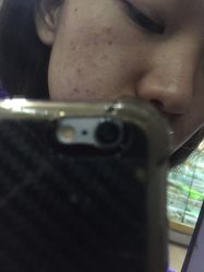 -金品苗方专业祛痘中心