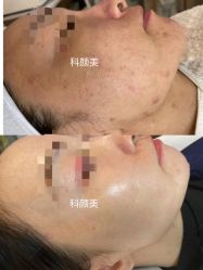 -美肤盾祛痘·问题肌头疗管理中心