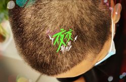 -大麦微针植发全国连锁