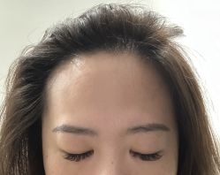 点击看大图 体验后-智美品质医美