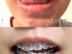 -极光口腔·矫正种植修复(锦江店)
