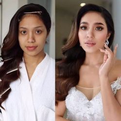 -美肤盾祛痘·问题肌头疗管理中心