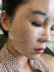 体验后-深圳芙必优医疗美容·抗衰中心