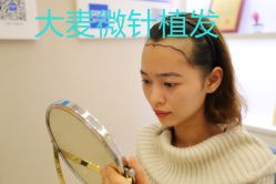 -大麦微针植发丨全国连锁