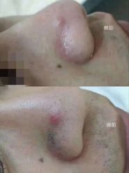 -蕾特恩专业祛痘·皮肤管理