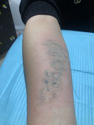 -秦好山专业洗纹身