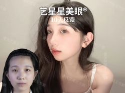 -Yestar重庆艺星医疗美容医院