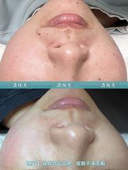 -清疣美疣·痣·斑净肤中心