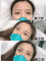 -久匠半永久纹眉