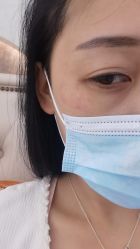 体验后-JS医疗美容