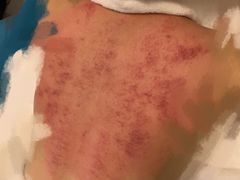 -康乃馨保健中心(第十一分店)