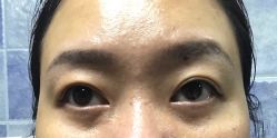 -天津伊美尔医疗整形美容专科医院