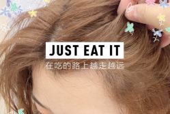 -大麦微针植发全国连锁