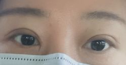 体验后-南宁华美医疗美容医院