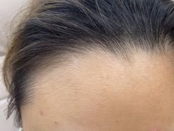 -美莱医疗美容医院