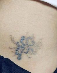 -雲艺刺青·洗纹身