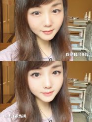 -针美汇欧邦医疗美容