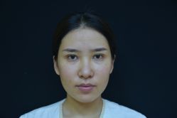 体验前-Yestar艺星整形美容医院