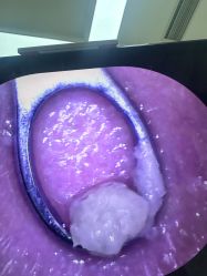 -凡碧诗毛孔清洁收细