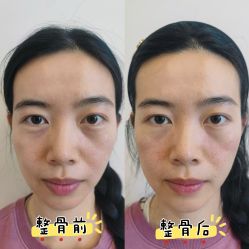 -颜和骨正·明哲式骨相美学整骨