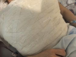 -四川华美紫馨整形外科医院