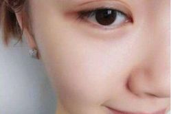 -SKINIST丽铂医疗美容