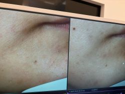-苑苑vbeauty科技美容SPA