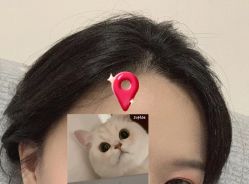 -大麦微针植发全国连锁