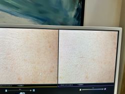-苑苑vbeauty科技美容SPA