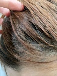 -熙朵美学植发·连锁品牌