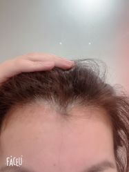 点击看大图 -舒欣头疗·俏丝谧语 白发脱发专业护理