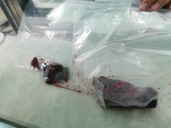 -大连医科大学附属第二医院(总院)