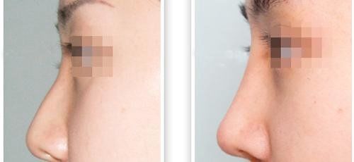 点击看大图 -SKINIST丽铂医疗美容