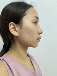 -四川米兰柏羽医学美容医院