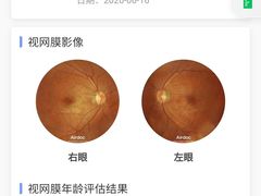 -宝岛眼镜(福州宝龙二店)