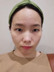 体验后-南京医科大学友谊整形外科医院