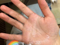 -重庆医科大学附属第一医院(本部)