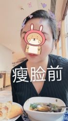 体验前-北京丽星翼美医疗美容