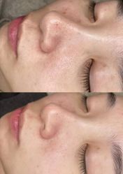 点击看大图 -栖SPA·ONDA ·海菲秀·皑皑科技美肤中心