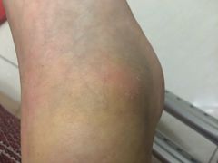 -大韩庄韩氏祖传正骨